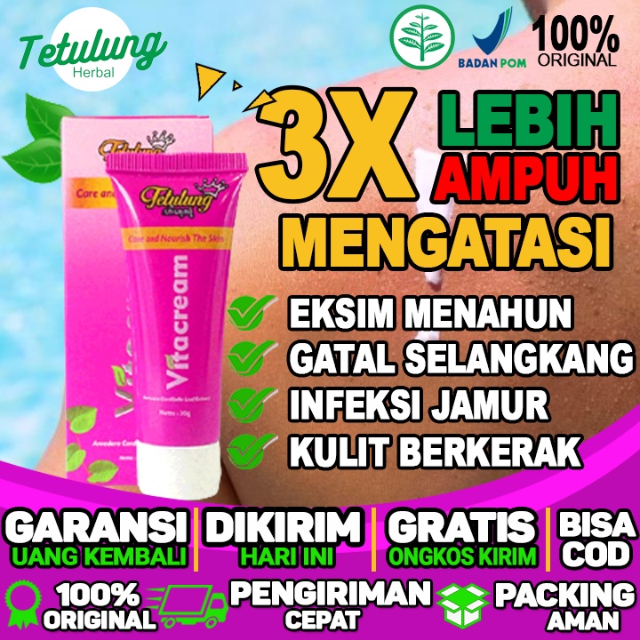 Obat Salep Gatal Gatal Pada Kulit Salep Gatal Gatal Untuk Ibu Hamil Dan Eksim Menahun