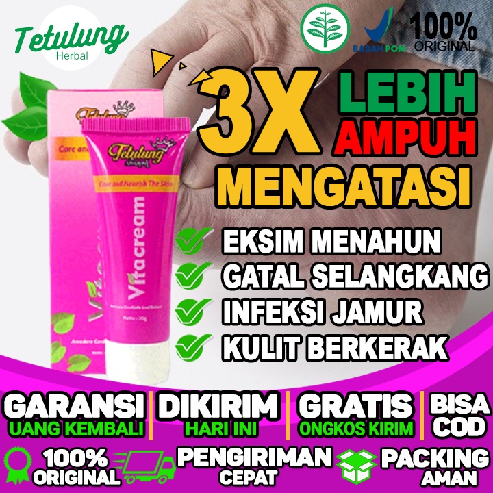 Salep Untuk Gatal Selangkangan Salep Untuk Gatal Jamur Kulit Salep Gatal Untuk Jari kaki
