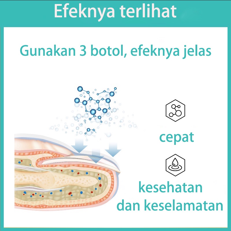 Krim perbaikan kuku Aman tidak sakit/Perawtan kuku Anti virus Mengatasi gatal Serum menghilangkan onokomikosis/Krim kuku jamur Krim perbaikan memperbaiki kuku jamur