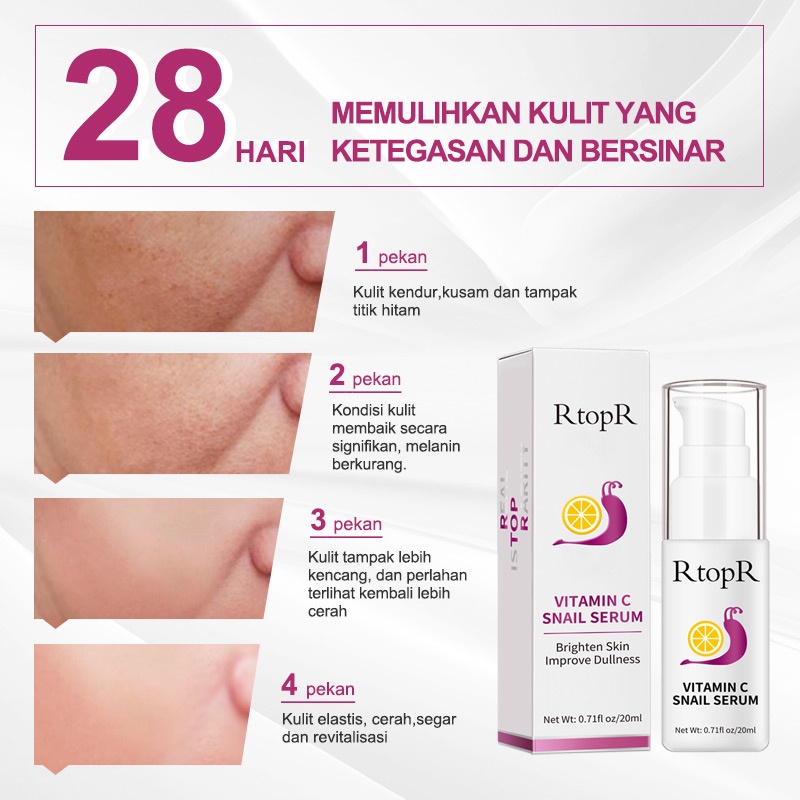 [BPOM]RtopR  Serum Pemutih Vitamin C  Esensi VC Asam Hyaluronic  Pelembab  Hapus Bintik Bintik Memudarkan Bintik Hitam  Siput  Perawatan Kulit Anti-Penuaan 20ml