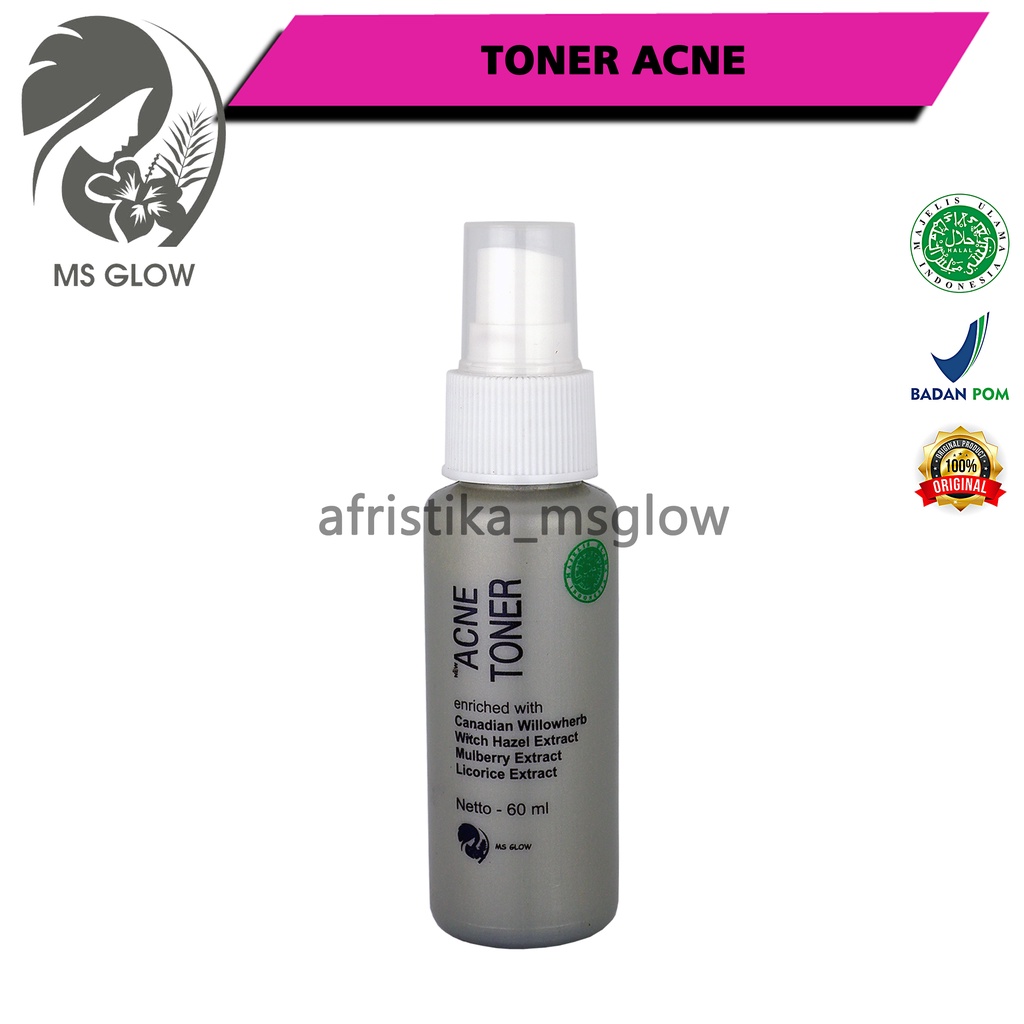 Ms Glow Toner Acne Original