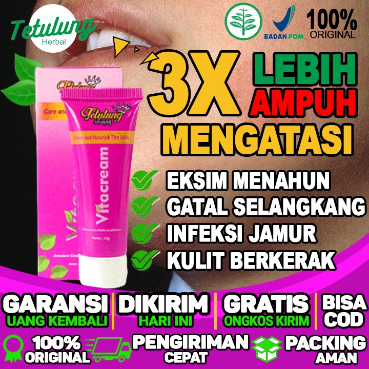 Salep Gatal Eksim Paling Ampuh Salep Gatal Eksim di area wajah Dan Infeksi Menahun