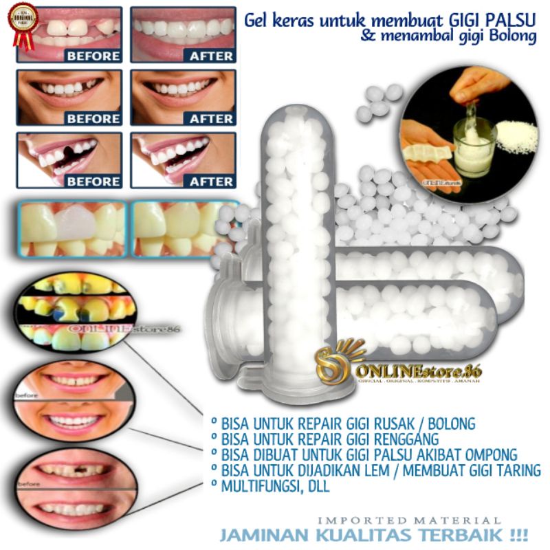 [ ORIGINAL 100% ] GIGI PALSU TEMPTOOTH TEMPORARY TOOTH Diy Repair Kit Lem Tambalan Gigi Rusak Lem Ge