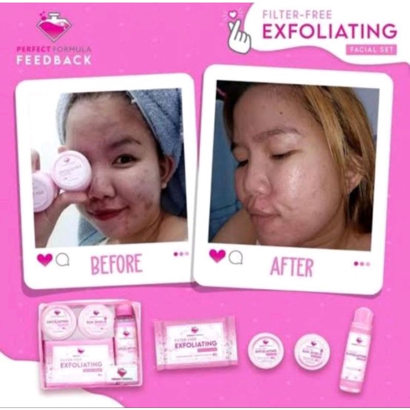 brilliant perfect/exfoliating mild(menghilangkan flex, noda bekas jerawat, komedo putih, komedo