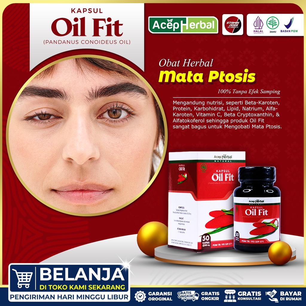 Obat Mata Ptosis Lipatan Kelopak Mata beda sebelah mata sipit sebelah Gangguan Pada Kelopak Mata Kel
