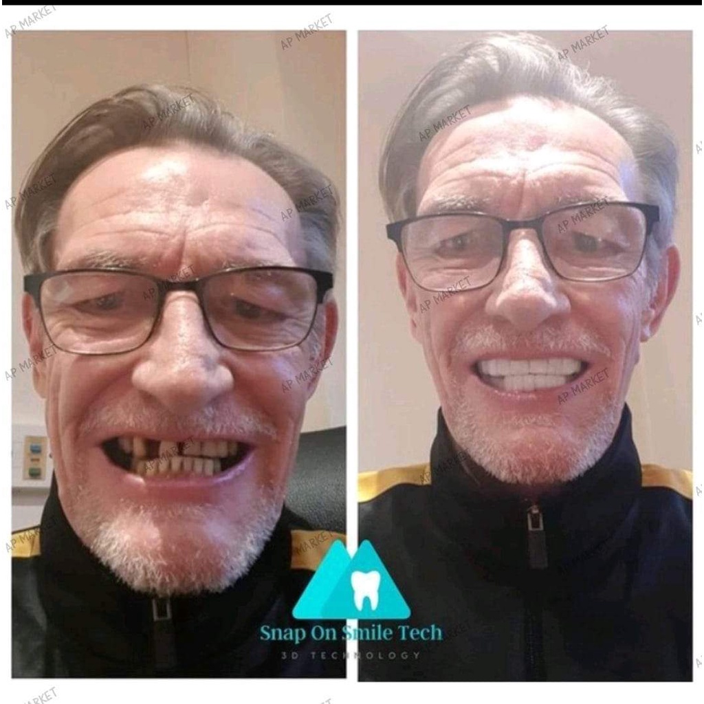 Gigi Palsu Atas Bawah 1 SET SNAP ON SMILE Gigi Lepas Pasang Pemutih Gigi Instan Gigi Putih Permanen