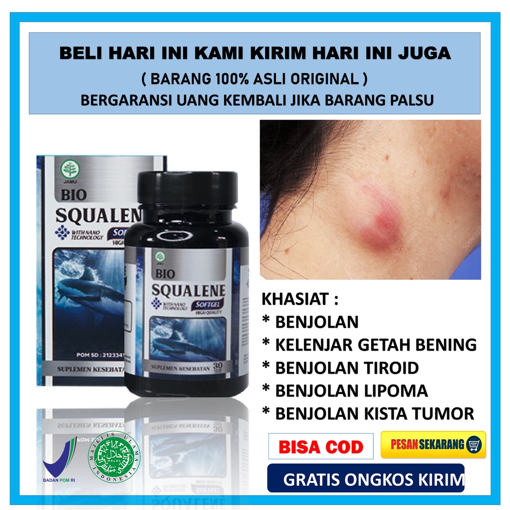 Jual Obat Benjolan Lipoma Kelenjar Getah Bening Gondokan Benjolan ...