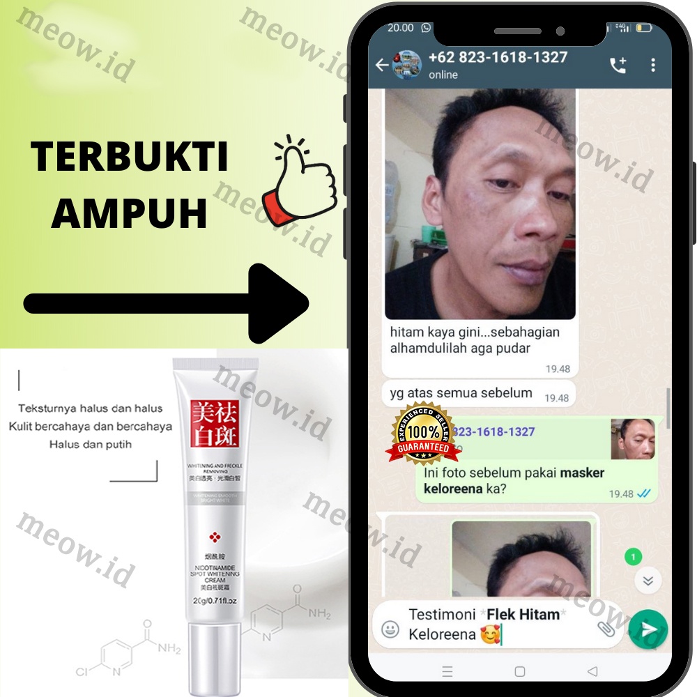 Penghilang flek hitam Night whitening salep flek hitam White neng cream flek hitam penghilang flek hitam di wajah 20g Cream Salep Pemutih Efektif Penghilang Bintik hitam Diwajah Jerawat Dan Bekas Jerawat