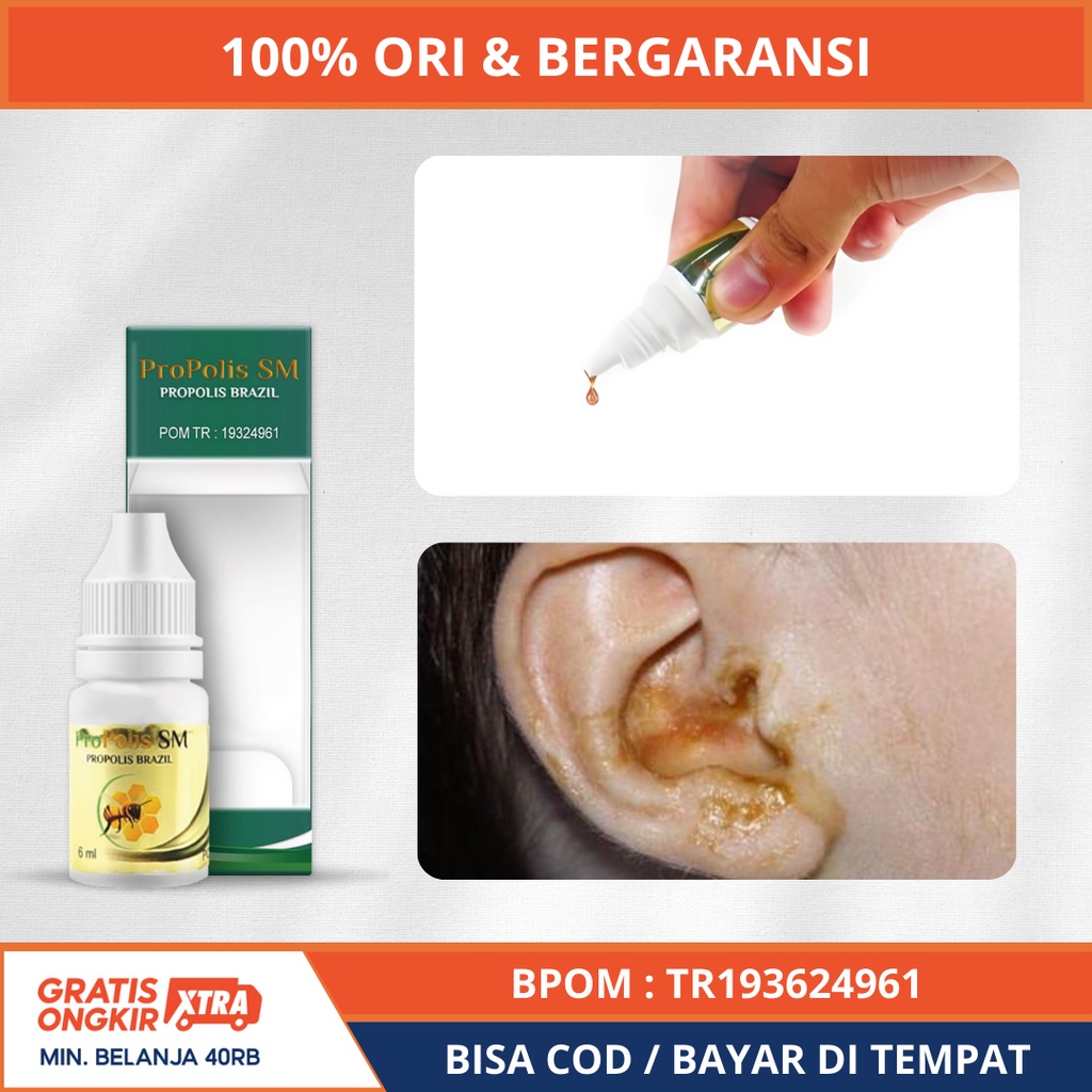 Obat Kotoran Telinga Keras