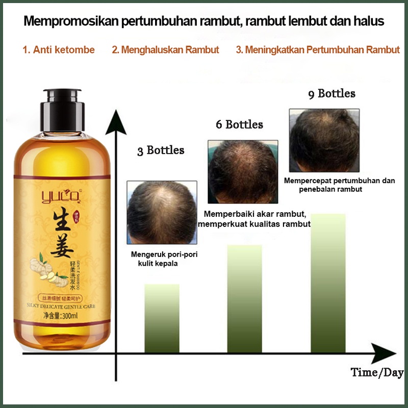 Sampo jahe Shampo penumbuh rambut Shampo anti rambut rontok 300ML Ketombe Merangsang pertumbuhan rambut Mencegah kebotakan Garis rambut Rambut rontok Bahan herbal jahe