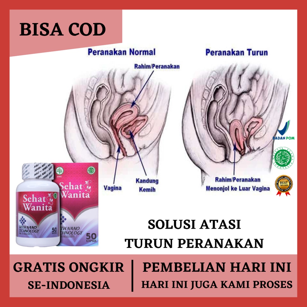 Obat Turun Peranakan, Obat Peranakan Menonjol, Obat Peranakan Kendur, Obat Turun Peranakan Wanita, O