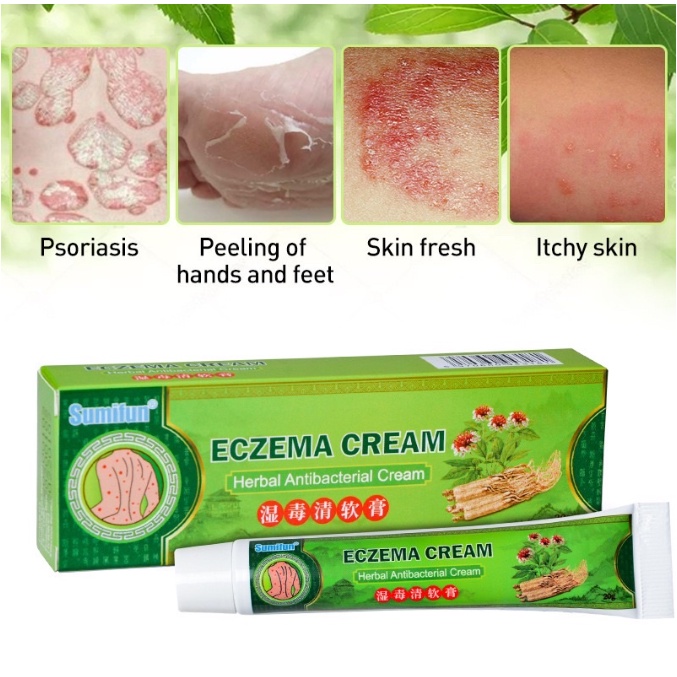 【ORIGINAL】Salep gatal Salep Eksim Salep kulit Krim psoriasis paling ampuh 20g Kulit Kepala Psoriasis Tangan Tinea Kaki Bau Versicolor Menghambat Dermatitis Jamur Anti Gatal Cream