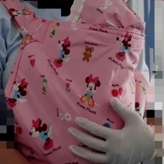 gendongan kangguru (metode kangguru bayi prematur)