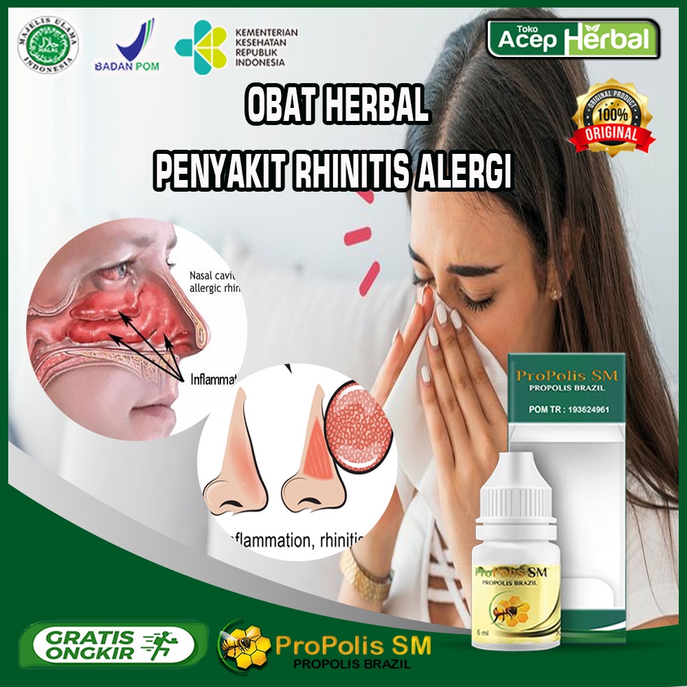 Obat alergi hidung - Obat penyakit Rhinitis alergi - Obat alergi debu - Obat alergi serbuk bunga - O