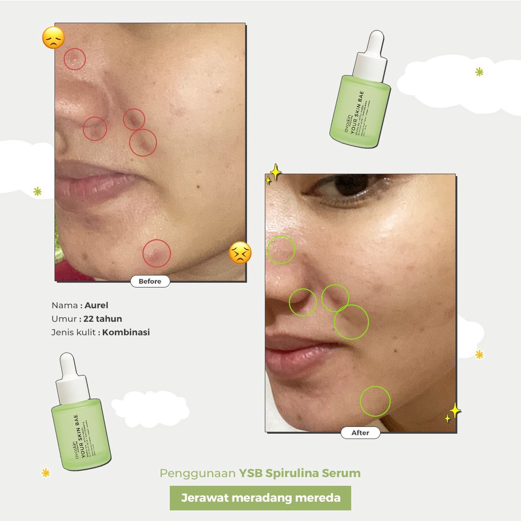 Avoskin Your Skin Bae Serum Spirulina + Witch Hazel + Glycolic Acid + Niacinamide (30ml) untuk Kulit Berjerawat