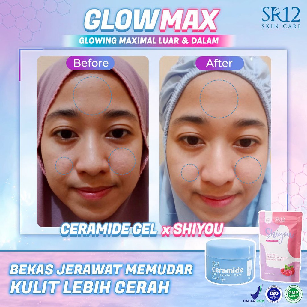 Shiyou Collagen SR12 Minuman Collagen Mencerahkan Kulit Pemutih Badan BPOM