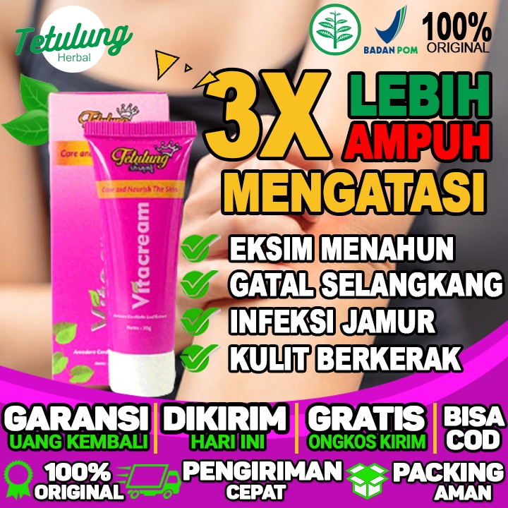 Obat Gatal Selangkangan Original Jamur Obat Gatal Selangkangan Original Karena Alergi