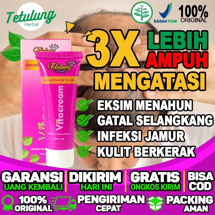 Salep Untuk Selangkangan Gatal Dan Merah Salep Gatal Untuk di area kepala dan kulit berkerak