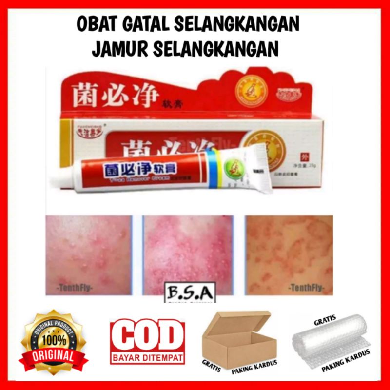 OBAT GATAL SELANGKANGAN JAMUR SELANGKANGAN
