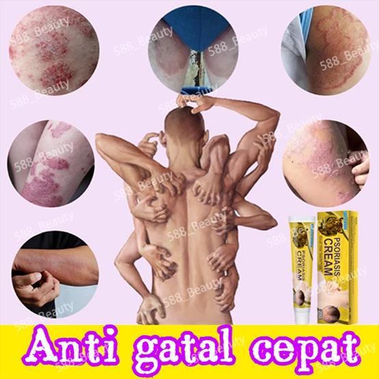 Salep gatal Salep eksim Salep kulit gatal Salep jamur kulit Obat salep gatal Obat salep psoriasis eczema cream salep gatal gatal