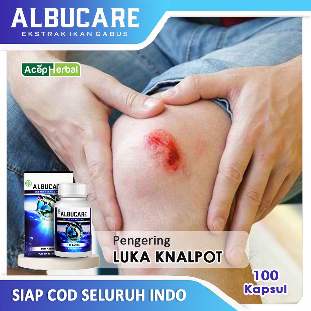 Jual Obat Luka Terkena Knalpot Obat untuk Luka Kena Knalpot Salep Luka