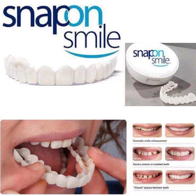 Snap On Smile Venners Gigi Original 100% 1Set Atas & Bawah Gigi Palsu