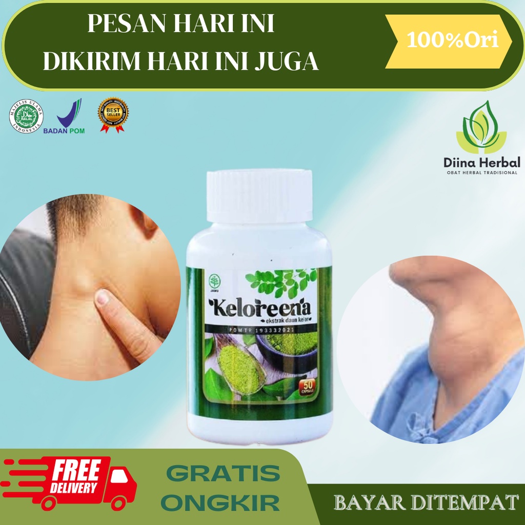 Obat Benjolan Dileher, Obat Kelenjar Getah Bening, Obat Benjolan Uci Uci Tiroid, Obat Penghilang Ben