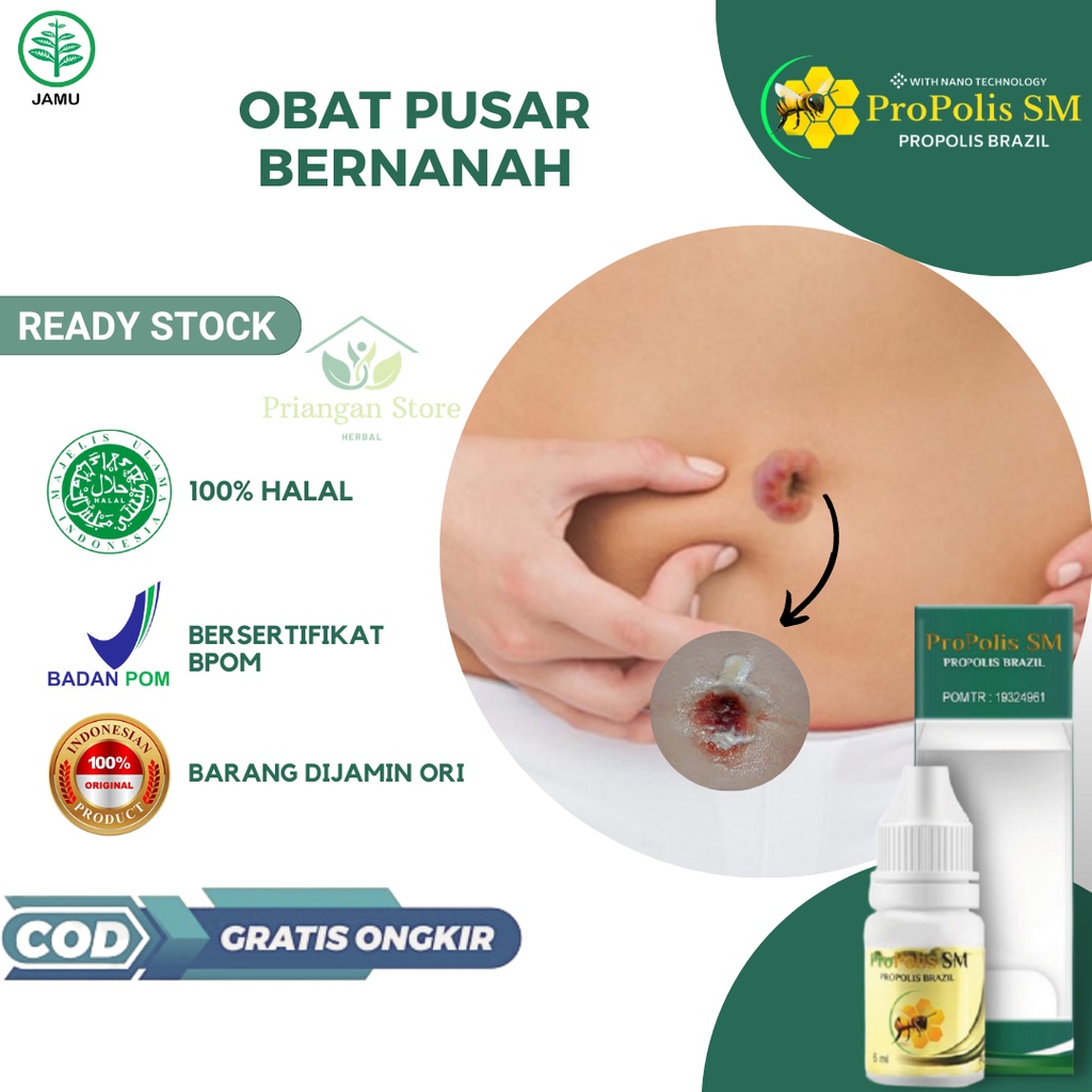 Obat Pusar Bernanah & Berair, Obat Granuloma Umbilikalis, Obat Pusar Bau, Obat Infeksi Jamur Pusar, 