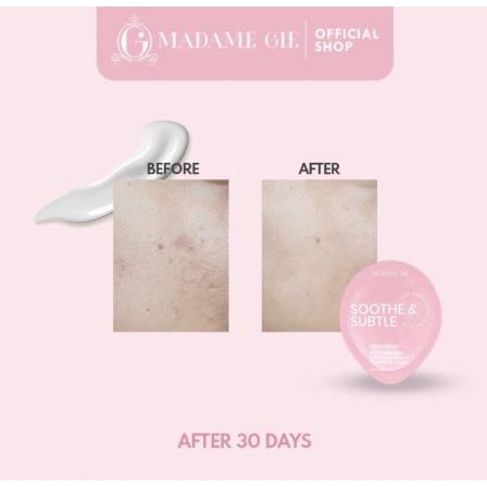 * NCC * Madame Gie Jelly Mask Skincare Masker Wajah Blister