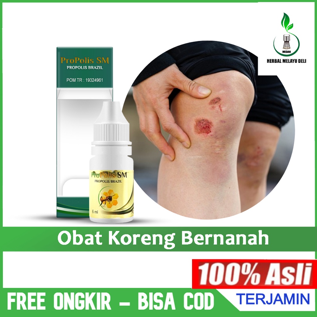 Obat Koreng Bernanah Luka Bernanah Pengering Luka Koreng Herbal Propolis SM