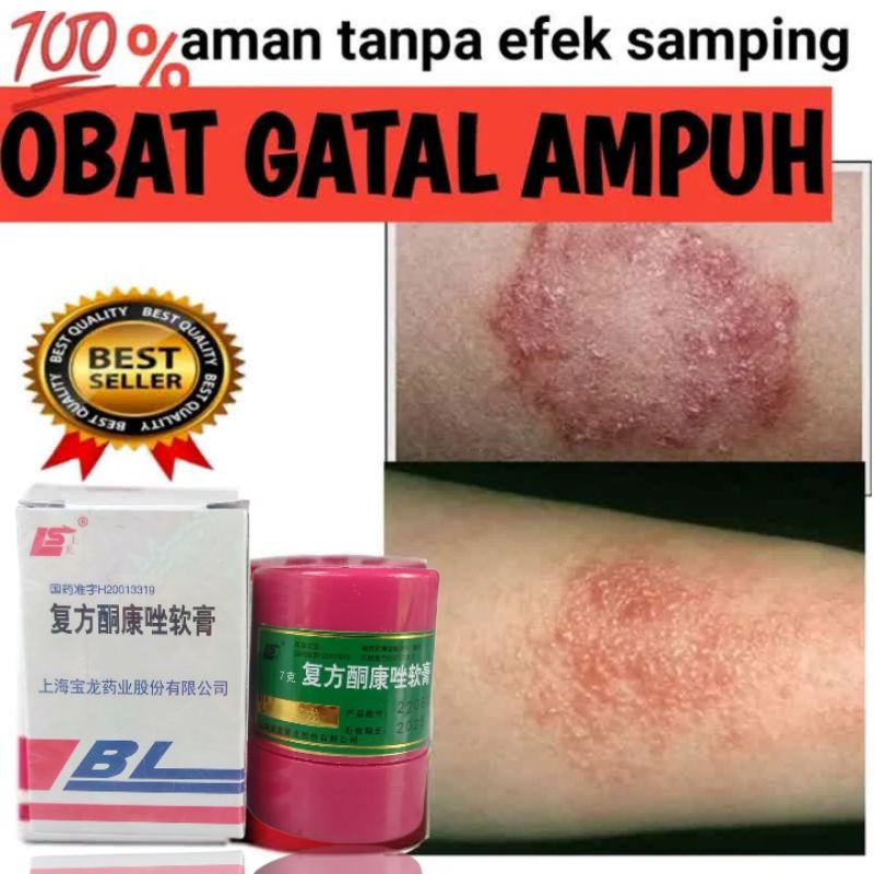 salep gatal paling ampuh | obat gatal salep  bl original 100% ori tanpa campuran