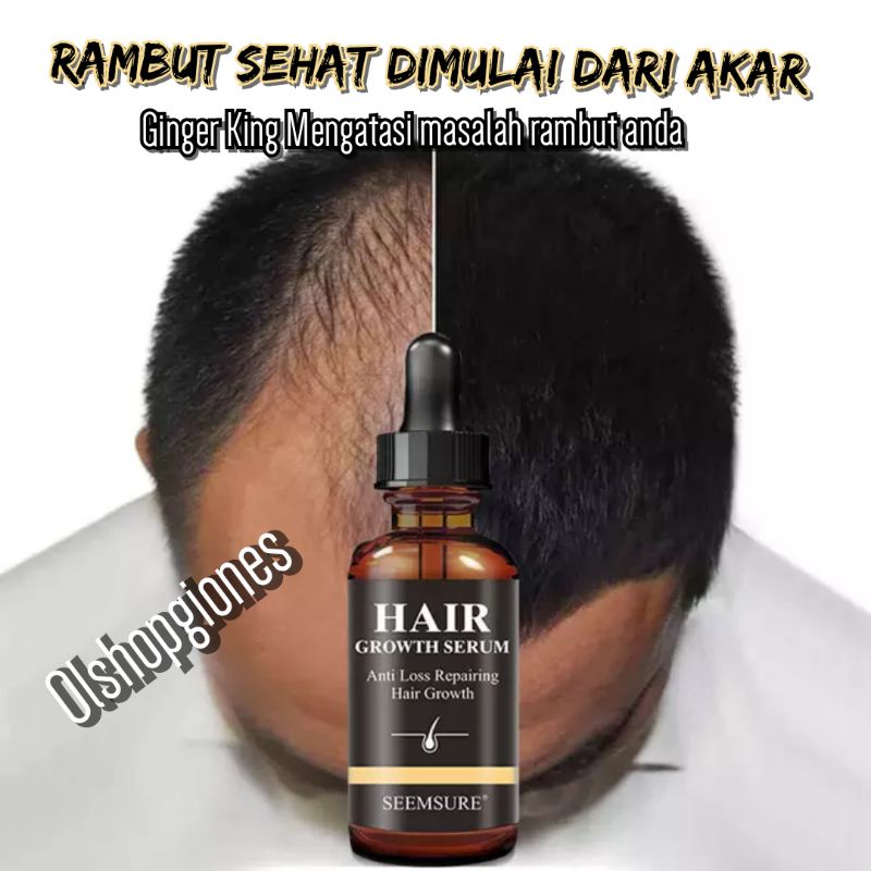 SEEMSURE GROWTH SERUM penumbuh rambut botak anti rontok aminexil spa