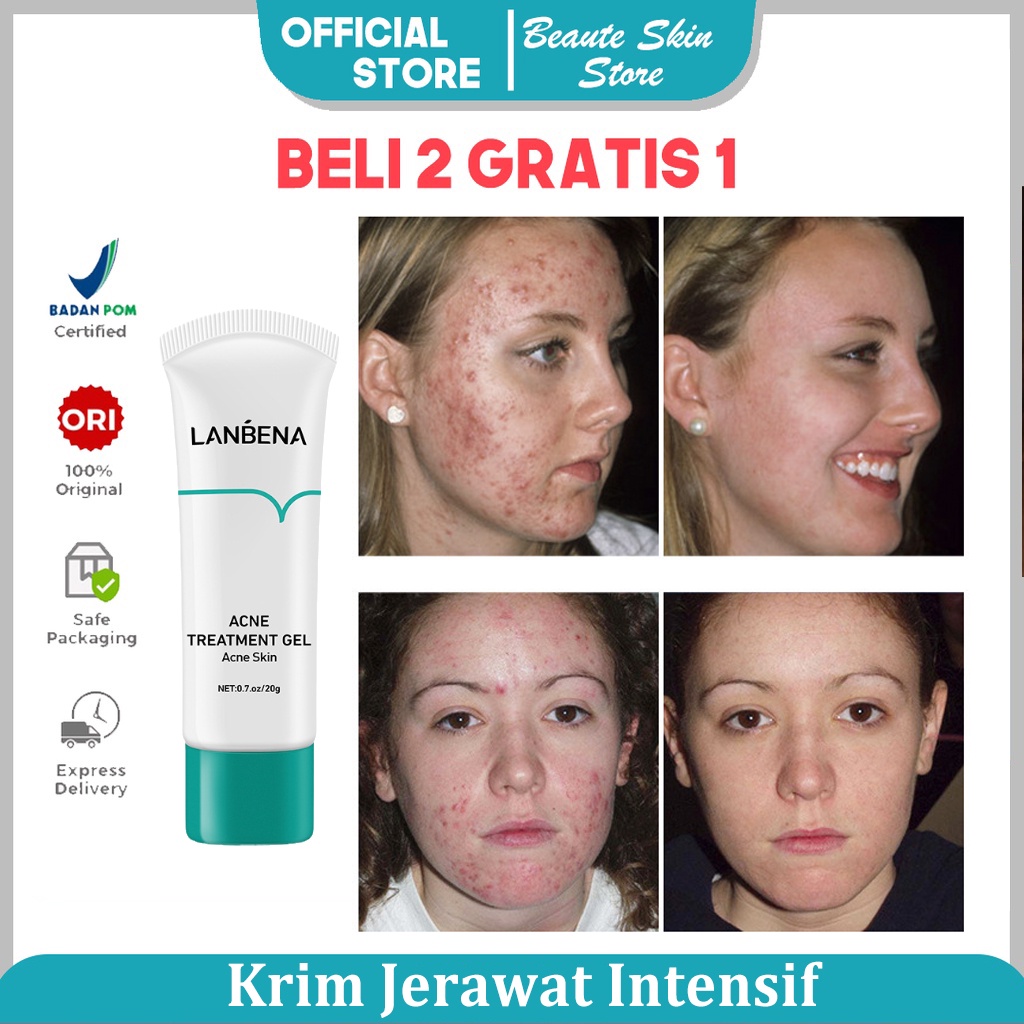 cream jerawat krim jerawat alat jerawat cream untuk jerawat cream jerawat ampuh krim malam jerawat Anti Jerawat penghilang jerawat salep jerawat serum penghilang jerawat pembersih jerawat acnes gel jerawat