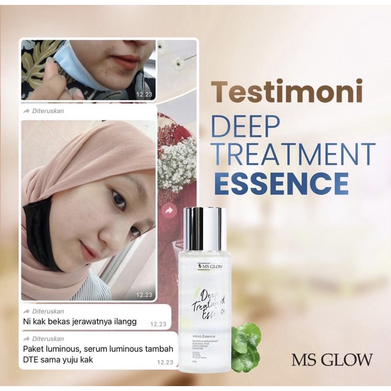 DEEP TREATMENT ESSENS CENTELLA MSGLOW MURAH