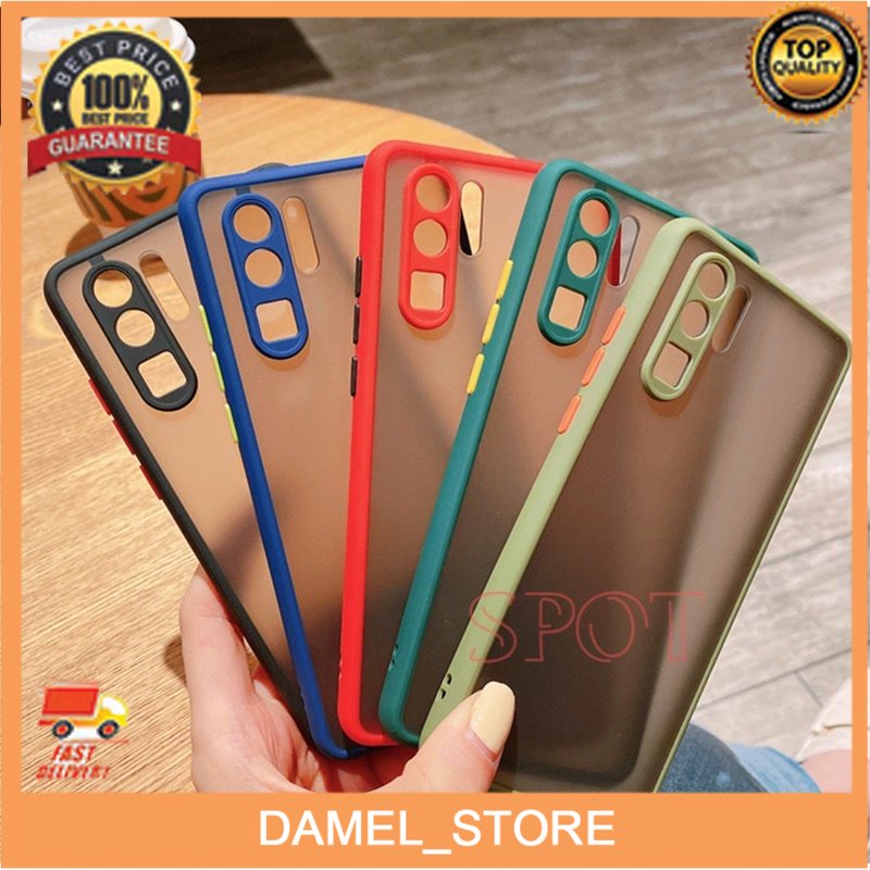 My Choice Aero Xiaomi Redmi S2 Pelindung Kamera