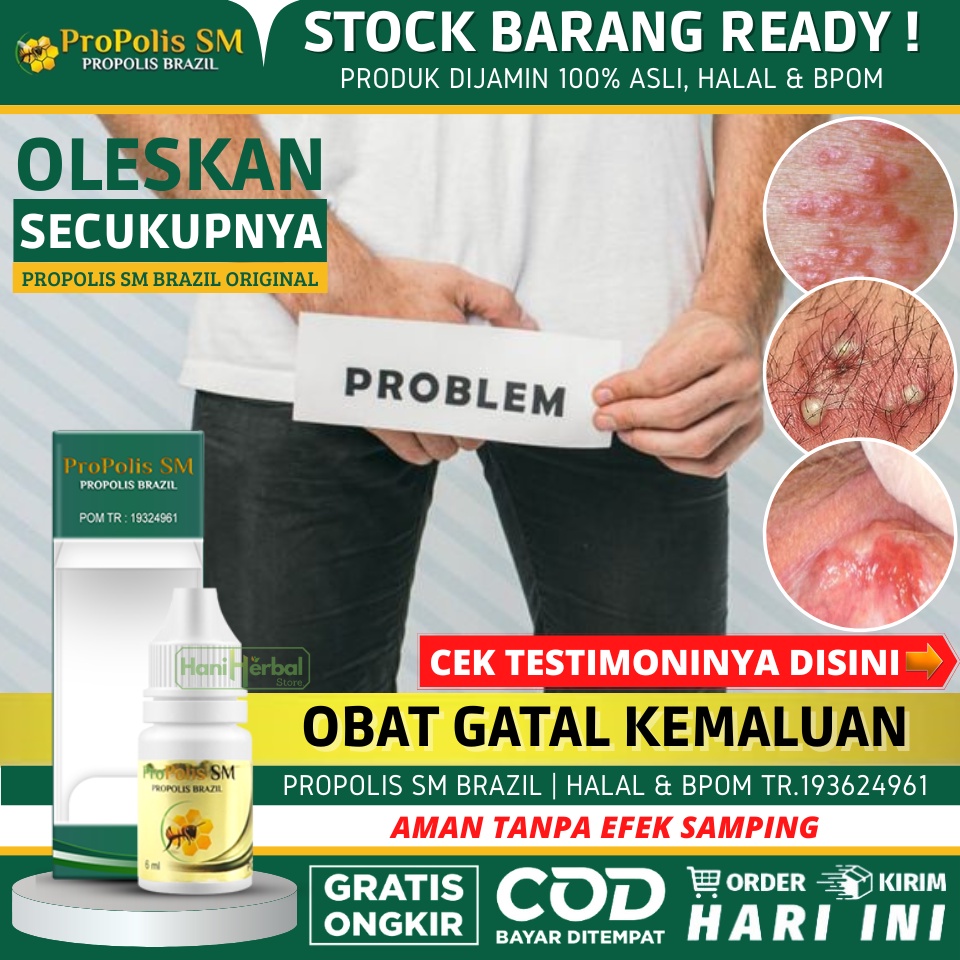 Obat Gatel Kelamin Pria 100% Alami - Obat Gatal Kemaluan Pria, Obat Infeksi Jamur di Kelamin, Obat K