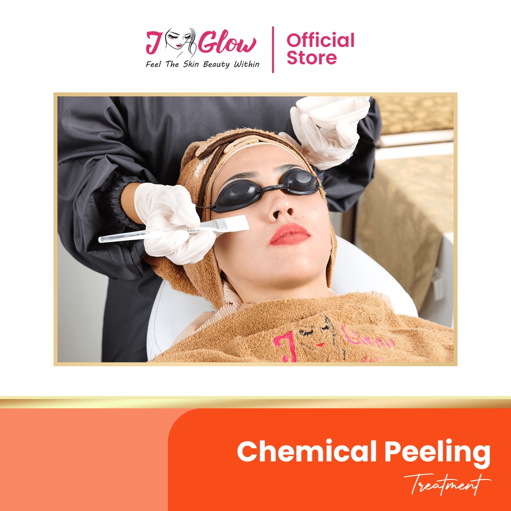 J-GLOW - Treatment Chemical Peeling Acne (Jglow Aestehtic Clinic)