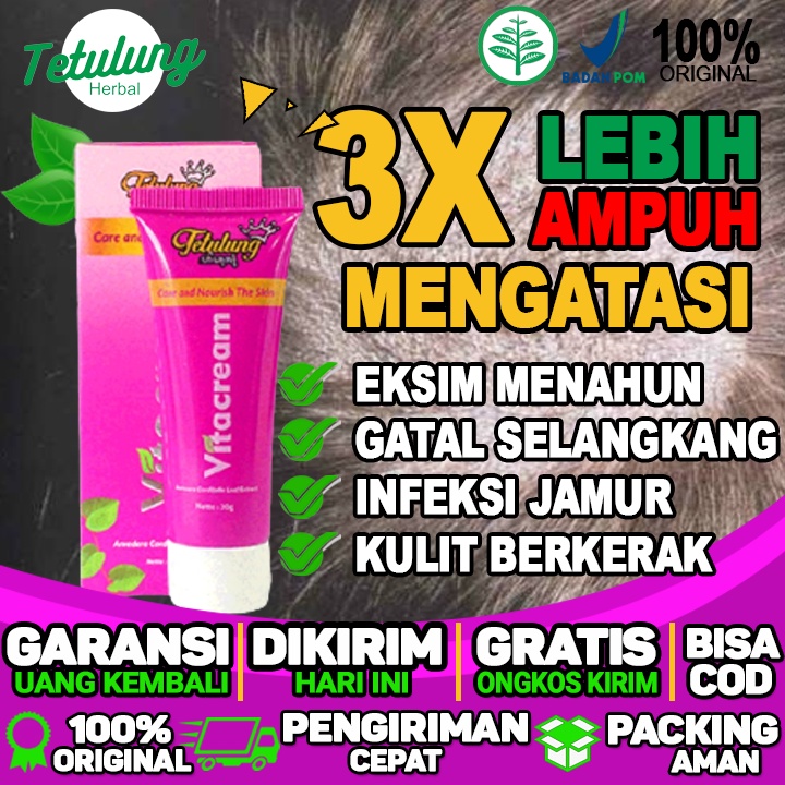 Obat Salep Gatal Alergi Paling Ampuh Salep Gatal Pada kepala Pria Dan Wanita Dan Kulit Berkerak