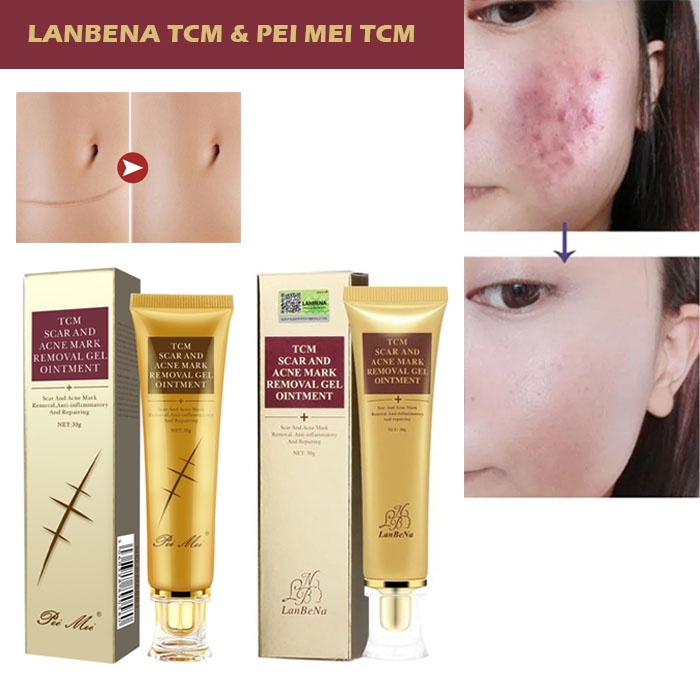 Beauty Jaya -TCM SCAR and ACNE REMOVAL gel ointment Penghilang Bekas Luka,Obat Jerawat Bopeng