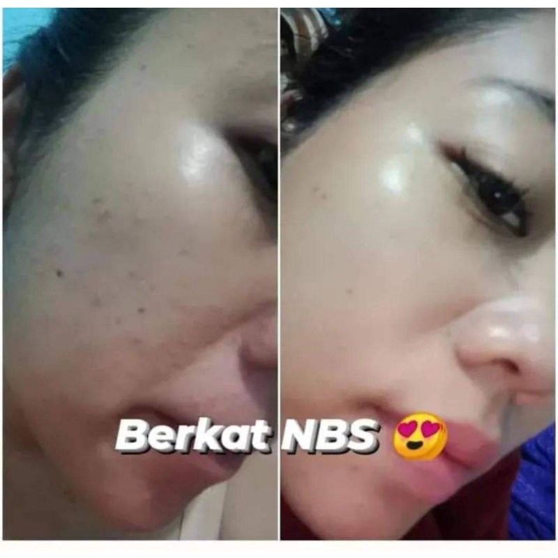 NBS SKINCARE PAKET ULTIMATE PLUS SERUM LIFTING