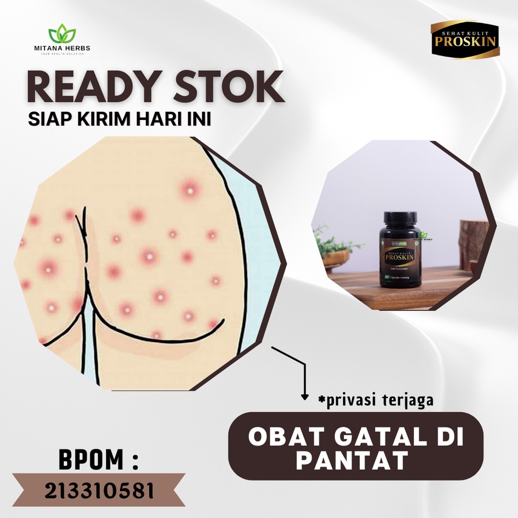 Mitana Herbal - Obat Gatal Pantat - Obat Gatal Selangkangan Hitam - Obat Pantat Bruntusan - Obat Pan