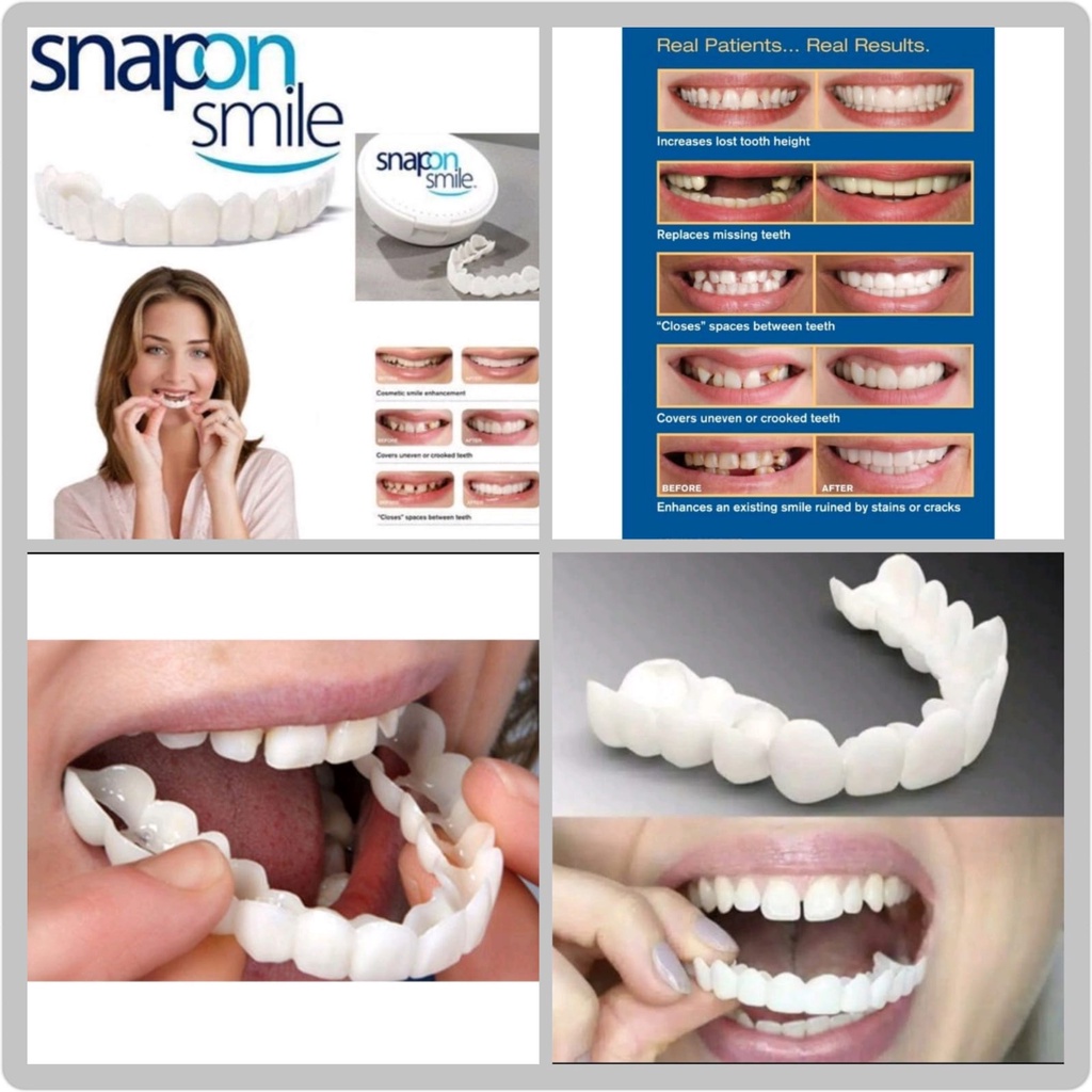 SNAP ON SMILE 100% ORIGINAL AUTHENTIC VENEER GIGI PALSU 1 SET ATAS BAWAH