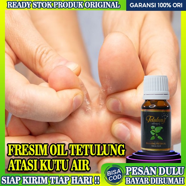 Jual Obat Kutu Air Pada Jari Kaki Tetulung Fresim Oil 10ml Kutu Air Di