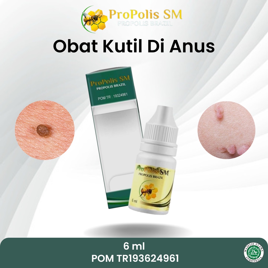 Obat Kutil Di Anus, Obat Daging jadi di anus, Obat Daging tumbuh di anus, Obat Kutil Lubang Anus, Ob