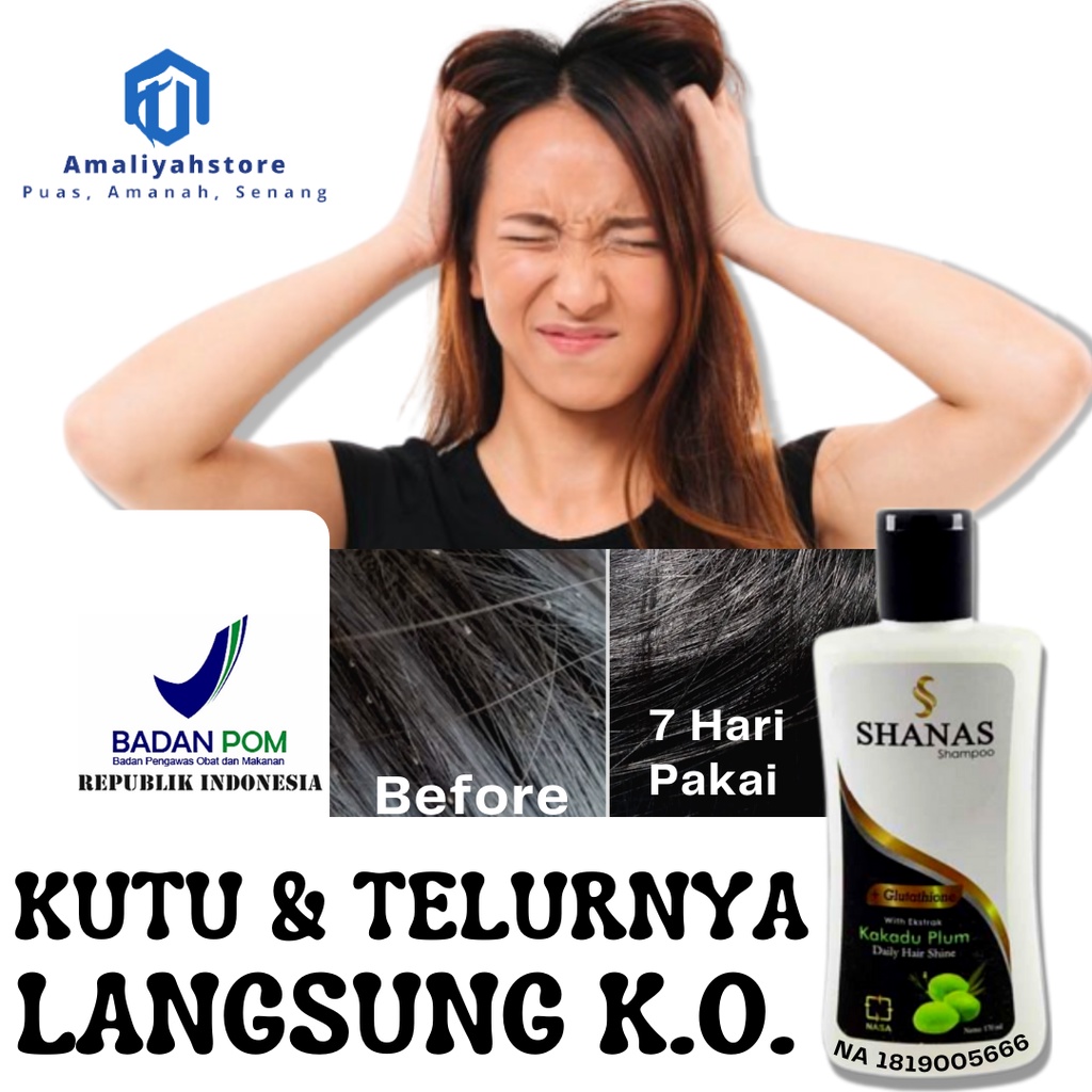 Shampo Shanas Nasa 175 Ml Original Pembersih Kutu Rambut Sampo Anti Kutu Rambut Anak Dewasa Shampoo Anti Ketombe Shampo Untuk Rambut Rontok Parah Paling Ampuh