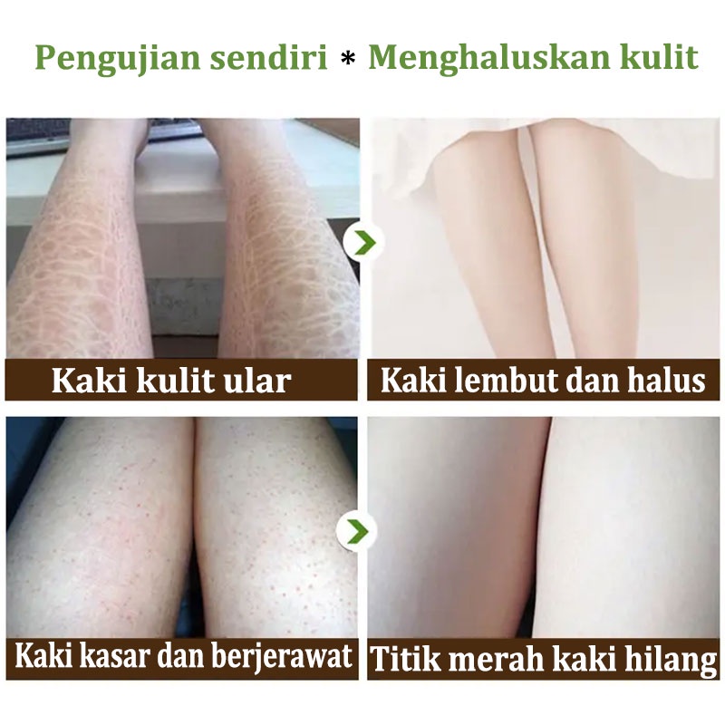 【Barang ready】scrub pengelupasan kulit  niacinamide scrub body dan butt eksfoliasi mengeksfoliasi lulur tubuh whitening scrub pemutih body pengelupasan kulit mati meningkatkan kulit halus pemutih kulit