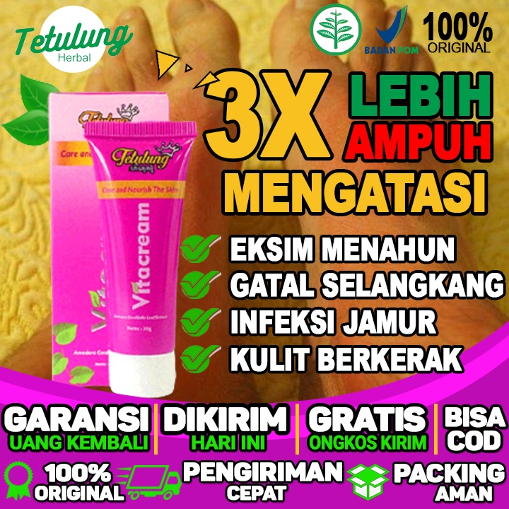 Salep Untuk Gatal Di Jari Tangan Salep Untuk Gatal Di Bokong Dan Salep Untuk Ketiak Iritasi Dan Gata