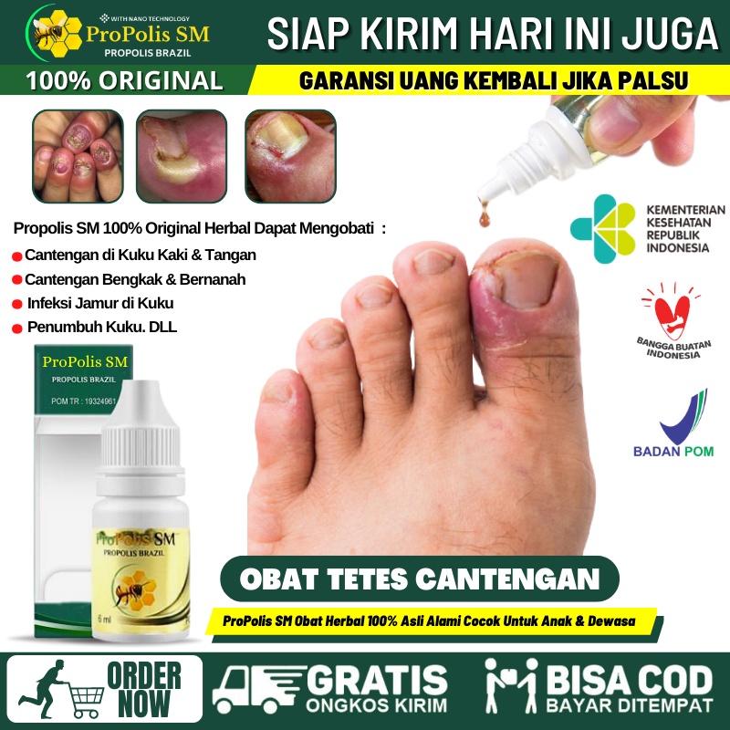 Obat Jempol Kaki Bengkak Akibat Cantengan, Obat Tetes Jempol Kaki Nyeri, Obat Jempol Kaki / Tangan K