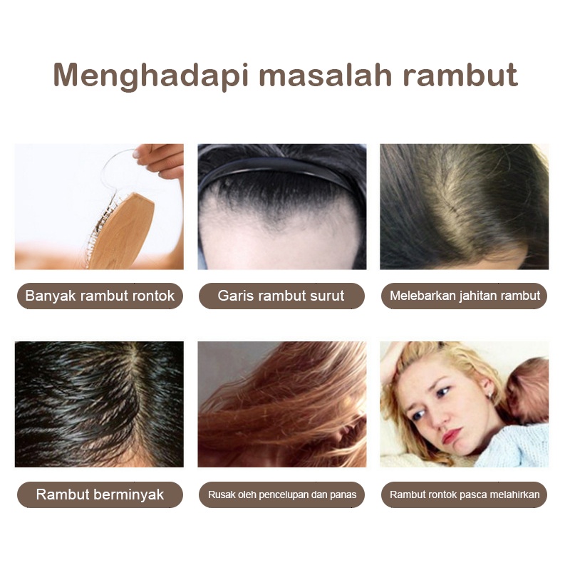 Ultimate Hair Loss Therapy Sisir Anti Rontok Sisir Anti Ketombe Sisir Penumbuh Rambut Perawatan Terapi EMS Sisir Pijat Getar Sikat