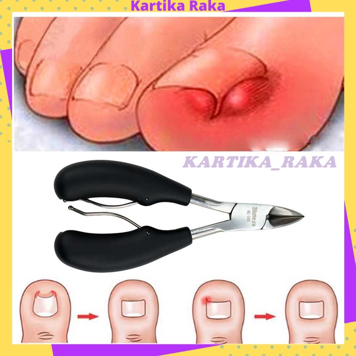 KR Gunting Kuku Miring Jempol Kaki Anti Cantengan Nyeri Toe Nail Clipper